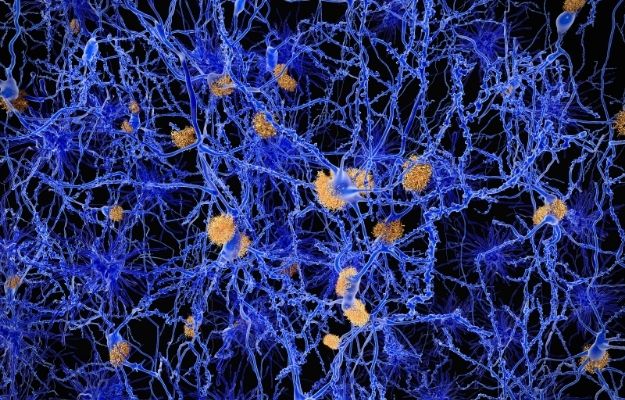 brain cell visualised by blue strings connected to yellow spots | Recent Findings | Alzheimer's Disease: How Epigenetics Is Changing What We Know