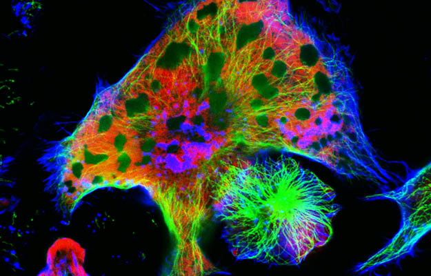 Neuroblastoma cells: nuclei are stained in red, microfilaments are in green and in blue | Epigenetic Subtypes Discovered in Neuroblastoma Super Enhancer Profiles