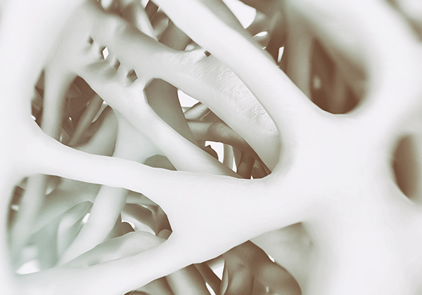3d rendering Osteoporosis | Researchers Identified the Role of KDM4B Gene in Skeletal Aging | body